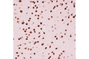 Anti-ATF2 Picoband antibody,  IHC(P): Mouse Brain Tissue (ATF2 抗体  (AA 93-450))