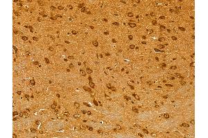 ABIN6262116 and ABIN6273047 at 1/100 staining Mouse brain tissue by IHC-P. (GSTA4 抗体  (N-Term))
