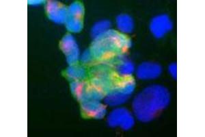 Shows human embryonic kidney cell line 293 stained with mouse monoclonal to UCHL1 monoclonal antibody, clone BH7  (green) and rabbit antibody to neurofilament NF-M (red). (UCHL1 抗体)
