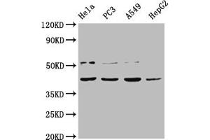 Western Blot Positive WB detected in: Hela whole cell lysate, PC-3 whole cell lysate, A549 whole cell lysate, HepG2 whole cell lysate All lanes: DUX4 antibody at 1:2000 Secondary Goat polyclonal to rabbit IgG at 1/50000 dilution Predicted band size: 45 kDa Observed band size: 45 kDa (DUX4 抗体  (AA 217-402))