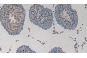 Detection of MMP3 in Rat Testis Tissue using Polyclonal Antibody to Matrix Metalloproteinase 3 (MMP3) (MMP3 抗体  (AA 278-450))