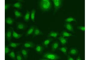 Immunofluorescence analysis of A549 cells using CETN2 antibody. (CETN2 抗体  (AA 1-172))