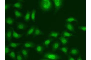 Immunofluorescence analysis of A549 cells using CETN2 antibody. (CETN2 抗体  (AA 1-172))