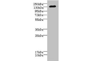 Western blot All lanes: CACNA2D2 antibody IgG at 4. (CACNA2D2 抗体  (AA 20-200))