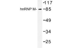 Image no. 1 for anti-Heterogeneous Nuclear Ribonucleoprotein M (HNRNPM) antibody (ABIN317716) (HNRNPM 抗体)