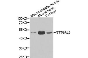 Western blot analysis of extracts of various cell lines, using ST3GAL3 antibody (ABIN5974085) at 1/1000 dilution. (ST3GAL3 抗体)