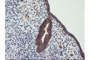 Image no. 6 for anti-Cancer/testis Antigen 1B (CTAG1B) antibody (ABIN1499889) (CTAG1B 抗体)