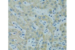 Immunohistochemistry of paraffin-embedded Human liver using STX1A Polyclonal Antibody at dilution of 1:100 (40x lens). (STX1A 抗体)
