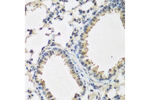 Immunohistochemistry of paraffin-embedded mouse lung using BMP2 antibody. (BMP2 抗体  (AA 283-396))