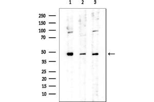 anti-Tubulin, delta 1 (TUBD1) (Internal Region) antibody