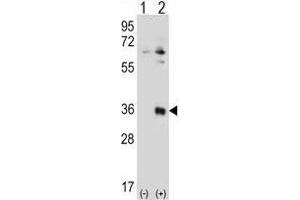 Western blot analysis of TSSK6 (arrow) using rabbit polyclonal TSSK6 Antibody (N-term) .