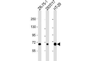 All lanes : Anti-SLC28A1 Antibody (Center) at 1:2000 dilution Lane 1: ZR-75-1 whole cell lysate Lane 2: 293T/17 whole cell lysate Lane 3: HT-29 whole cell lysate Lysates/proteins at 20 μg per lane. (SLC28A1 抗体  (AA 381-409))