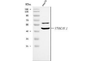Western blot analysis of CDw75/ST6GAL1 using anti-CDw75/ST6GAL1 antibody (ABIN7599361).