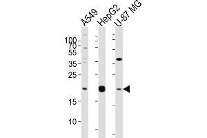 Western Blotting (WB) image for anti-Epiregulin (EREG) (AA 137-165), (C-Term) antibody (ABIN650993)