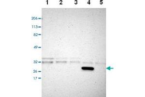 Western blot analysis of Lane 1: RT-4, Lane 2: U-251 MG, Lane 3: A-431, Lane 4: Liver, Lane 5: Tonsil with CREM polyclonal antibody. (CREM 抗体)