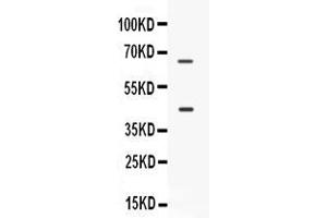 Western blot analysis of CD33 expression in SKOV3 whole cell lysates ( Lane 1).