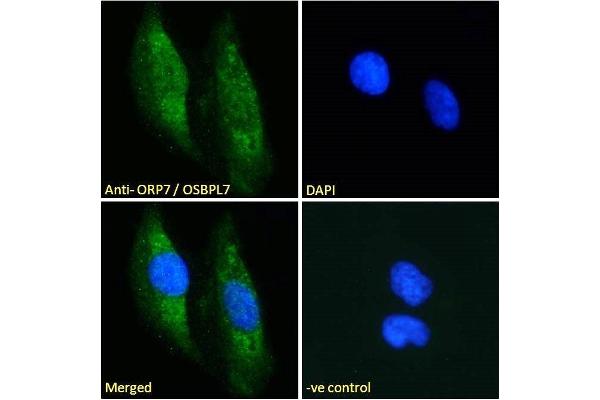 OSBPL7 抗体  (C-Term)