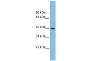 Image no. 1 for anti-Melanoma Antigen Family B, 4 (MAGEB4) (AA 35-84) antibody (ABIN6745113) (MAGEB4 抗体  (AA 35-84))