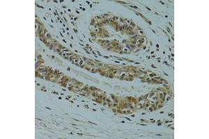Immunohistochemistry (IHC) image for anti-arginine/serine-Rich Coiled-Coil 1 (RSRC1) (AA 117-276) antibody (ABIN6147283)