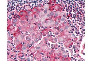 Immunohistochemistry (IHC) image for anti-Olfactory Receptor, Family 10, Subfamily R, Member 2 (OR10R2) (Extracellular Domain) antibody (ABIN1049175)