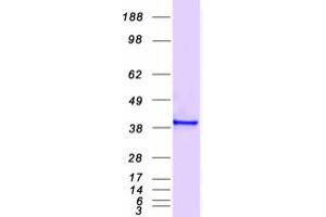Western Blotting (WB) image for Annexin A2 (ANXA2) (Transcript Variant 2) protein (Myc-DYKDDDDK Tag) (ABIN2714737)