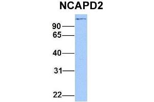 Host:  Rabbit  Target Name:  NCAPD2  Sample Type:  Hela  Antibody Dilution:  1. (NCAPD2 抗体  (C-Term))
