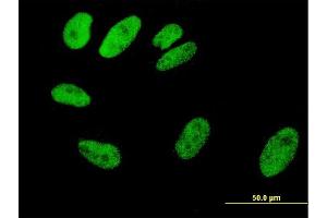 Immunofluorescence of monoclonal antibody to SRF on HeLa cell. (SRF 抗体  (AA 406-508))
