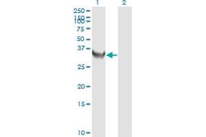 Western Blot analysis of TYMS expression in transfected 293T cell line by TYMS monoclonal antibody (M01), clone 3A1.