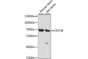 Western blot analysis of extracts of various cell lines, using CDY1B antibody (ABIN7266365) at 1:1000 dilution. (CDY1B 抗体  (AA 60-320))
