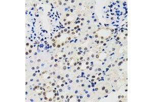 Immunohistochemistry of paraffin-embedded mouse kidney using CIRBP antibody. (CIRBP 抗体  (AA 1-172))