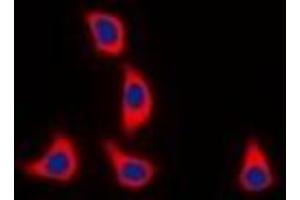 Immunofluorescent analysis of WASF1 (pY125) staining in K562 cells. (WASF1 抗体  (pTyr125))