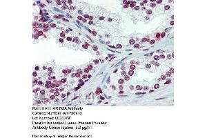Immunohistochemistry with Human Prostate lysate tissue at an antibody concentration of 5. (ARID5A 抗体  (C-Term))