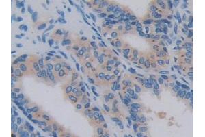 Immunohistochemistry (IHC) image for anti-Interleukin 17 Receptor A (IL17RA) (AA 377-534) antibody (ABIN1859360)