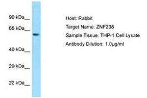 Image no. 1 for anti-Zinc Finger Protein 238 (ZNF238) (AA 143-192) antibody (ABIN6749839) (ZNF238 抗体  (AA 143-192))