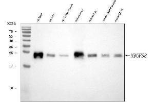 Western blot analysis of NDUFS8 using anti-NDUFS8 antibody (ABIN7599086).