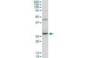 DNAJB6 polyclonal antibody (A01), Lot # 060309JCS1. (DNAJB6 抗体  (AA 1-241))