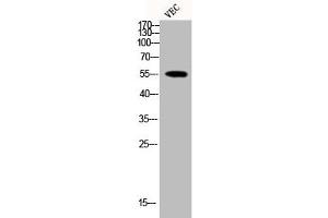 Western Blot analysis of VEC cells using Phospho-MEF-2 (T319) Polyclonal Antibody (MEF2A 抗体  (pThr319))