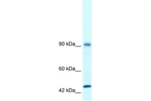 Western Blotting (WB) image for anti-RNA Binding Motif Protein 10 (RBM10) antibody (ABIN2460169)