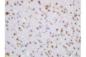 Formalin-fixed and paraffin embedded rat brain labeled with Rabbit Anti-WRB Polyclonal Antibody, Unconjugated (ABIN1387386) at 1:200 followed by conjugation to the secondary antibody and DAB staining (WRB 抗体  (AA 71-174))