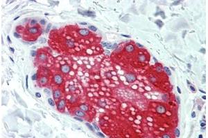 Anti-SUSD2 antibody  ABIN960825 IHC staining of human skin, sebaceous gland. (SUSD2 抗体  (Internal Region))