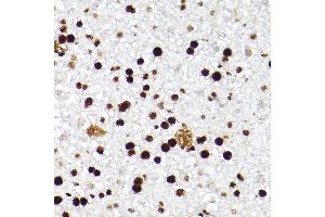 Immunohistochemistry (IHC) image for anti-Minichromosome Maintenance Complex Component 2 (MCM2) antibody (ABIN7268538)