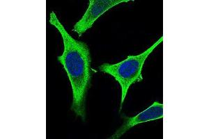 Immunofluorescence analysis of Hela cells using GABBR2 mouse mAb (green).