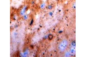 IHC-P analysis of Brain tissue, with DAB staining. (Pkc beta 1 抗体  (AA 342-600))
