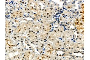 ABIN6259178 and ABIN6275070 at 1/100 staining Rat kidney tissue by IHC-P. (POLR1B 抗体  (Internal Region))