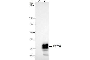 IP Image MEF2C antibody immunoprecipitates MEF2C protein in IP experiments. (MEF2C 抗体)