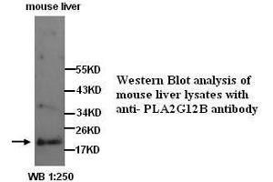 Image no. 1 for anti-Phospholipase A2, Group XIIB (PLA2G12B) (N-Term) antibody (ABIN790922) (PLA2G12B 抗体  (N-Term))
