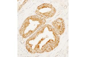 anti-MARCKS-Like 1 (MARCKSL1) (AA 145-195) antibody