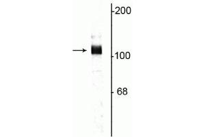 Western blot of rat hippocampal lysate showing specific immunolabeling of the ~115 kDa APP protein. (APP 抗体  (C-Term))