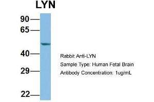 Host: Rabbit  Target Name: LYN  Sample Tissue: Human Fetal Brain  Antibody Dilution: 1.