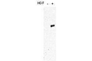 Western blot using  affinity purified anti-c-Met pY1349pY1356 antibody shows detection of phosphorylated c-Met.